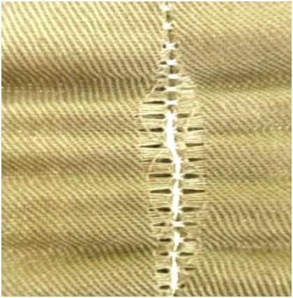 滑脱(スリップ)事故の一例