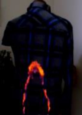 図4.表面フラッシュ現象の一例