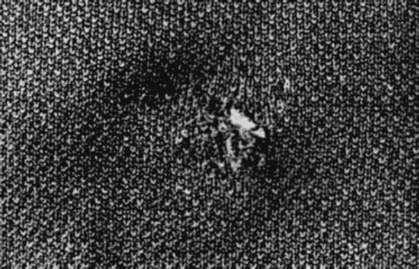 図7.摩擦溶融跡の一例(トレーニングパンツひざ部分)