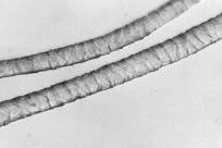 図9.毛繊維の側面