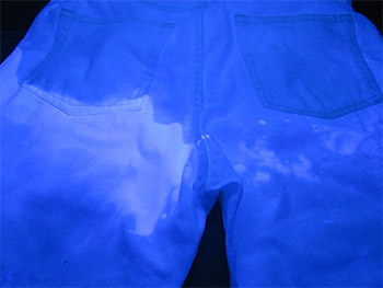 図6 ブラックライト試験の例