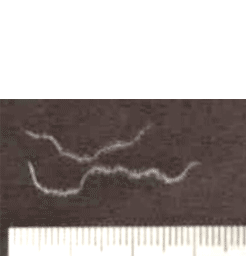 図4. ファイバー